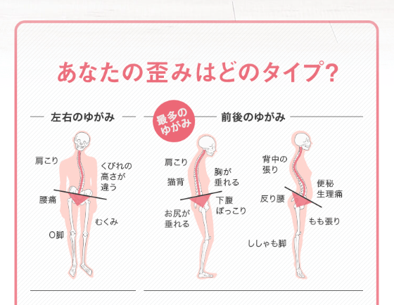骨格のゆがみを書いたイラスト