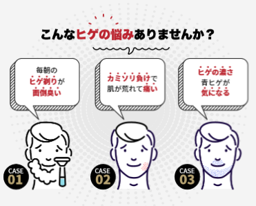 ヒゲの悩みを抱えている男性のイラスト